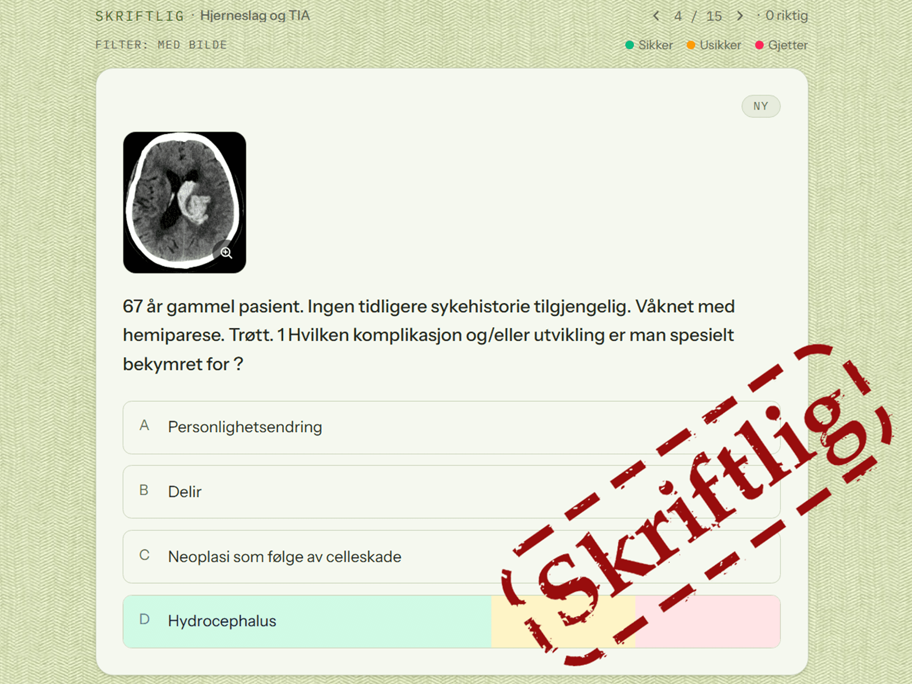 Et spørsmål med CT-bilde av hjernen, med teller for antall riktige og en forklaring på merkingen sikker, usikker og gjettet.