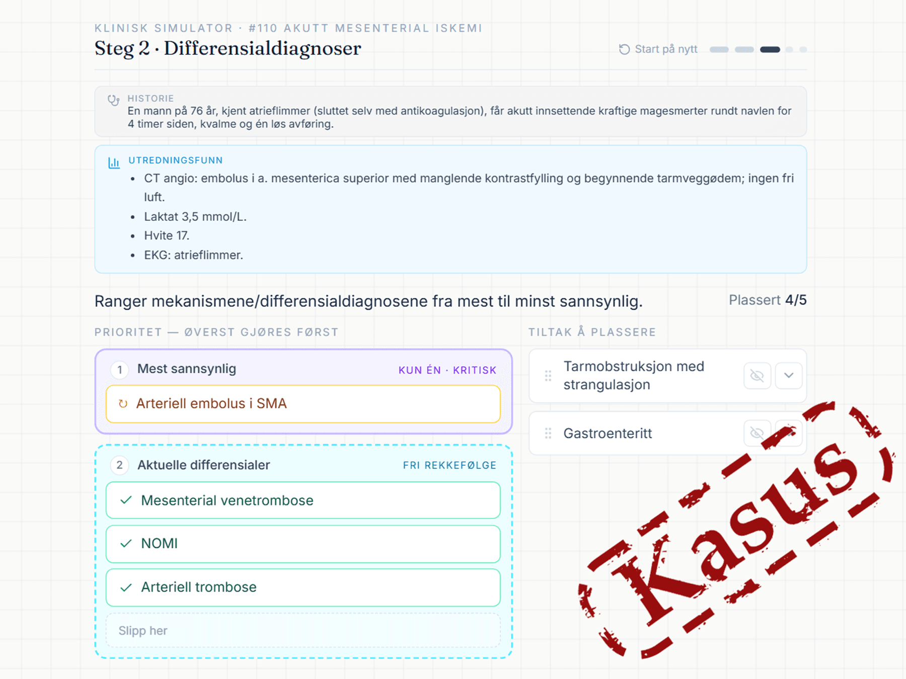 Steg 2 av samme kasus: utredningsfunnene er lagt til, og differensialdiagnosene rangeres fra mest til minst sannsynlig.