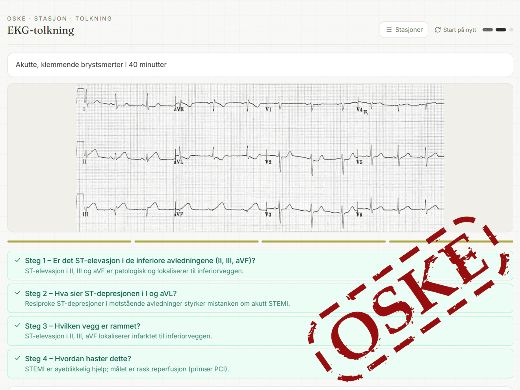 En OSKE-stasjon i EKG-tolkning: et tolvavlednings-EKG over fire besvarte steg med forklaring under hvert.
